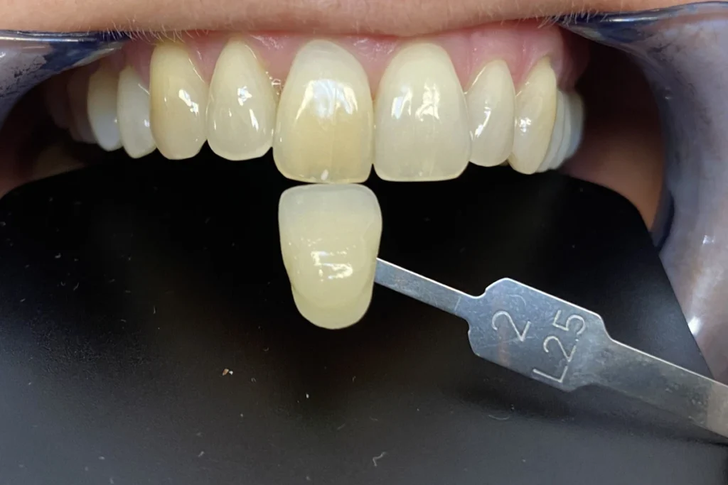 eclaircissement unitaire trouillas avant 1