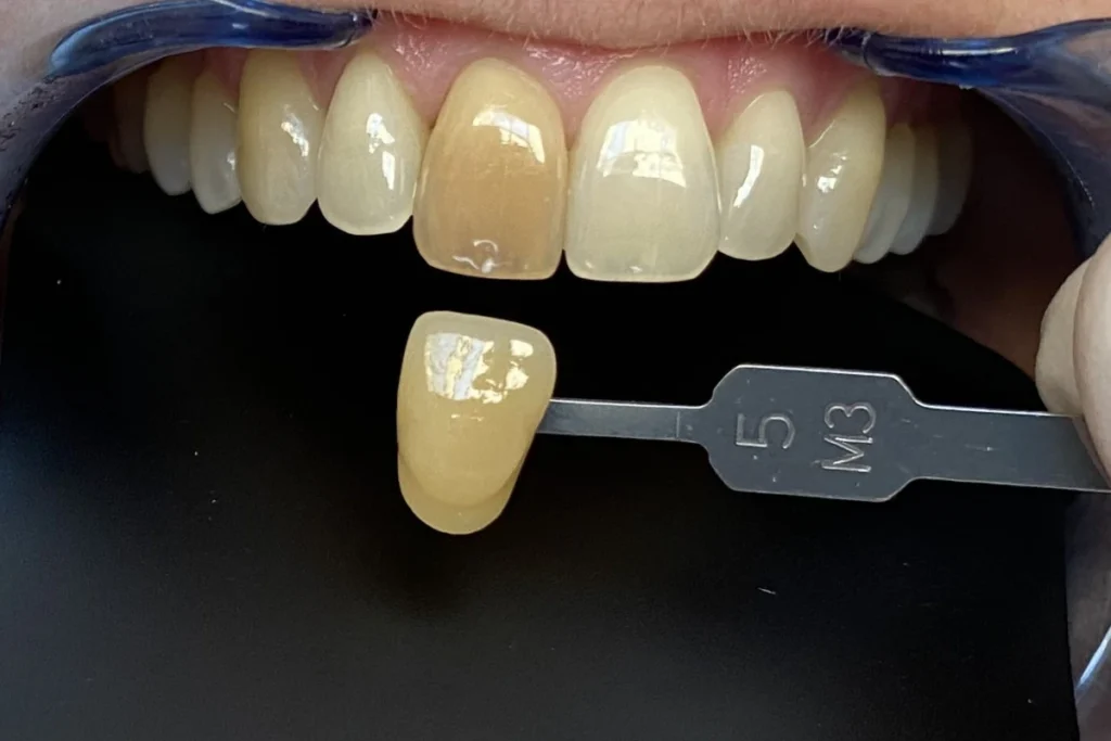 eclaircissement unitaire trouillas apres 1