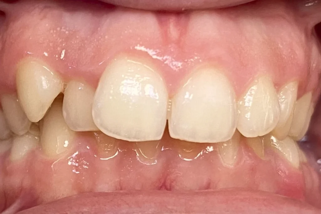 orthodontie adolescents 3 1