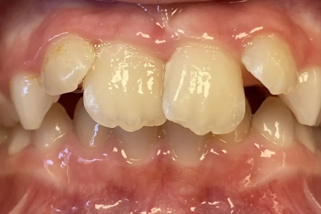 orthodontie enfant trouillas 1 1